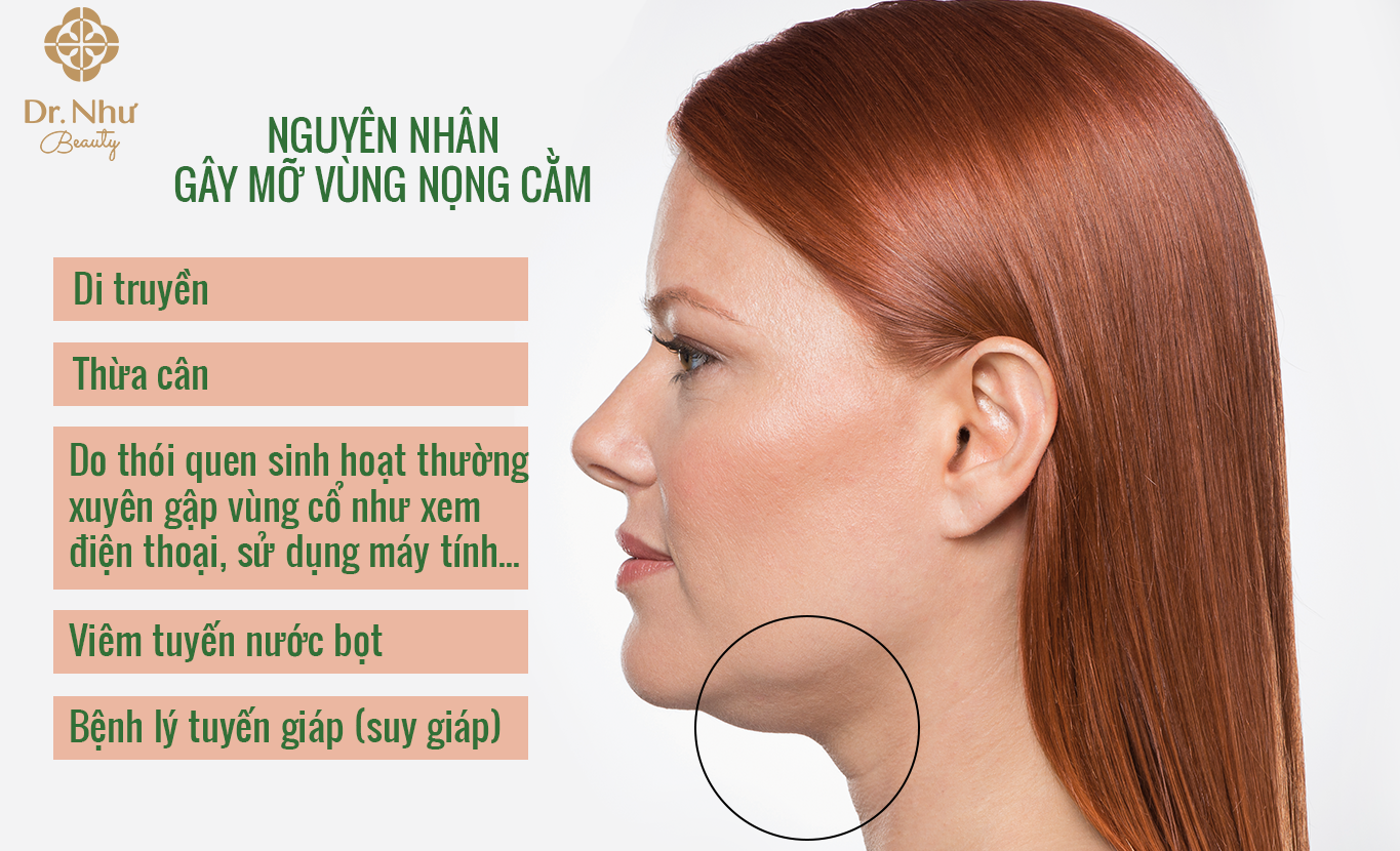 Nguyên nhân gây tích tụ mỡ vùng nọng cằm